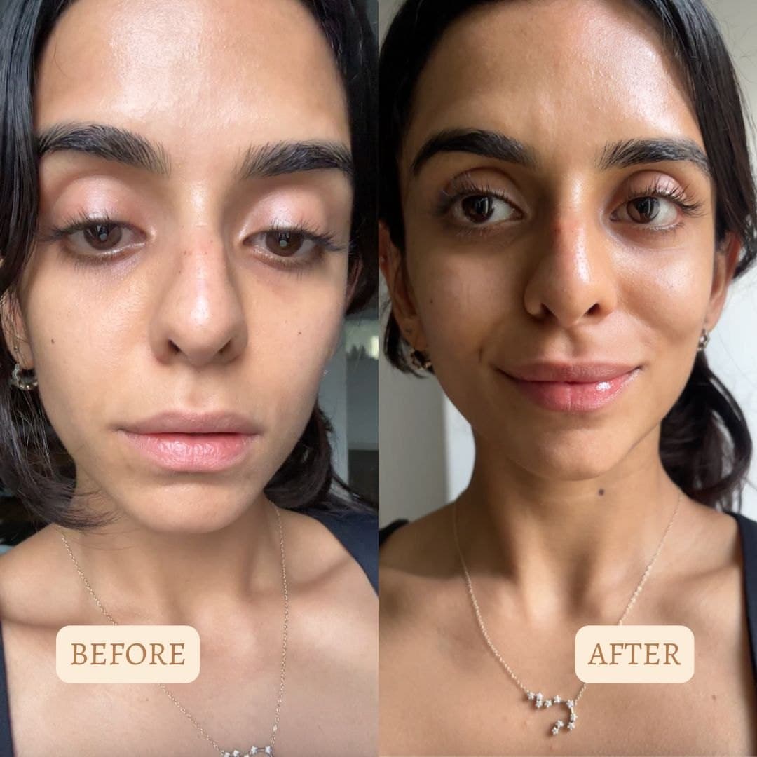 Sea Buckthorn Oil: The Northern Superfood Your Skin Is Missing